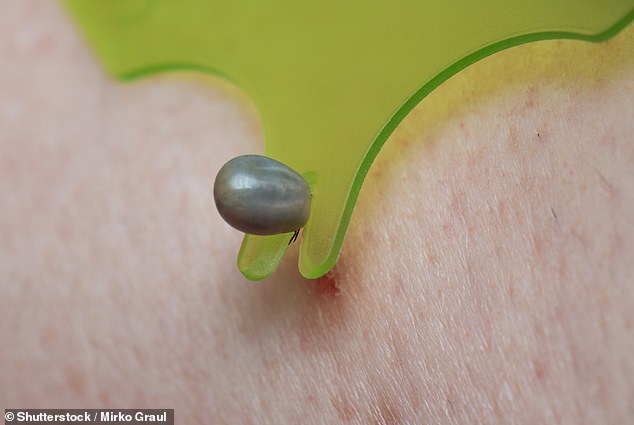 Northeast Leads US in Surging Tick Bite Emergency Visits