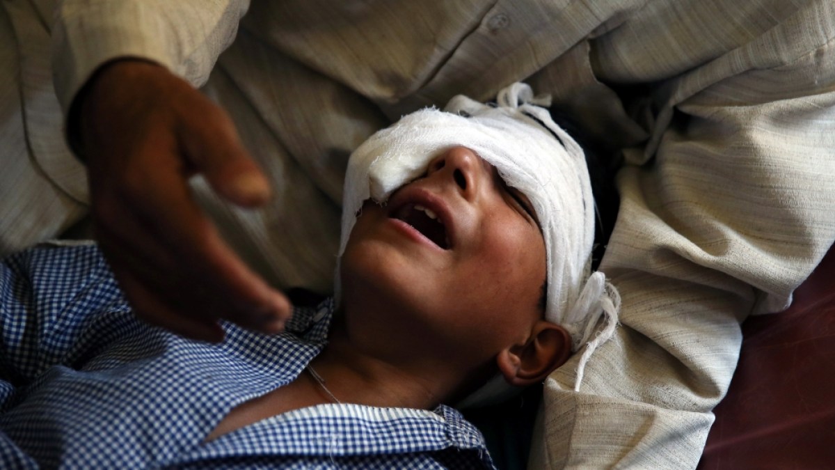 Le film indien Chauhaan est dénoncé au Cachemire pour banaliser les victimes d'armes à projectiles.