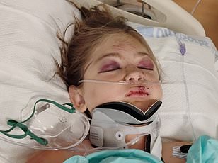 Une mère a survécu à un accident tragique sur le lac Bear, ayant perdu ses jambes dans les hélices du bateau remorqueur.