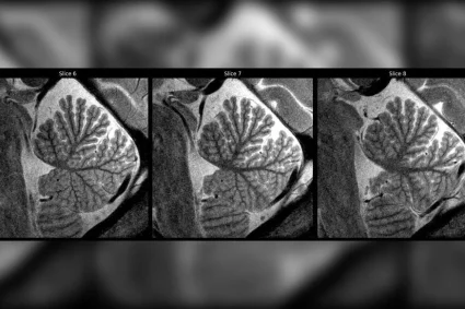 Des images fascinantes capturées par un scanner IRM