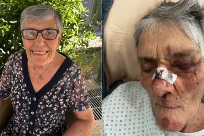 Les enfants de Jeannine, âgée de 83 ans, découvrent leur mère dans un état tragique à l'Ehpad Les Oliviers-de-Saint-Jean.