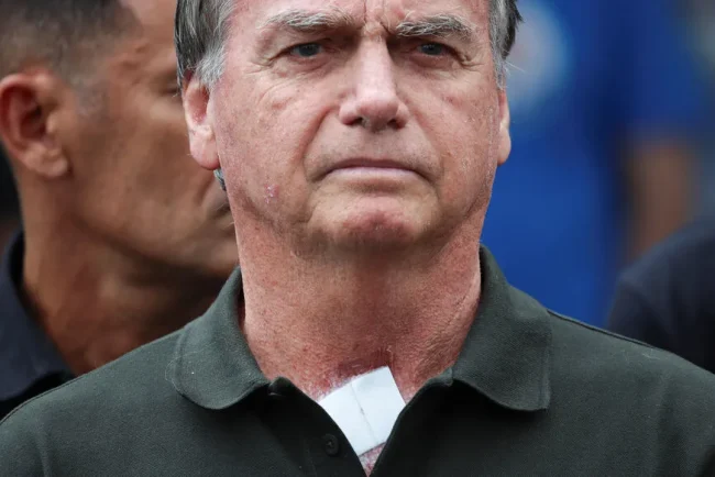 Jair Bolsonaro hospitalisé après des symptômes inquiétants