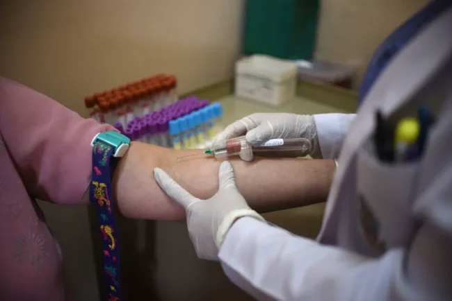 Mystère de l'hépatite A dans le Rhône : une vague inquiétante