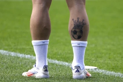 Arthur porte toujours les cicatrices d’un coup violent lors d’une partie de football